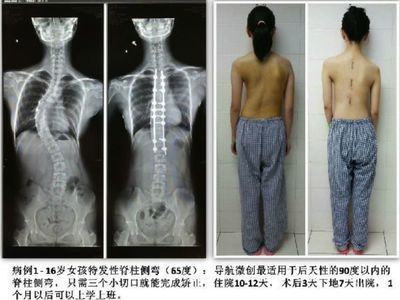 加固效果評估的實際案例 行業(yè)新聞 第4張