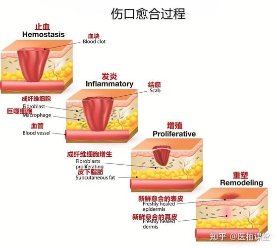 哪種補(bǔ)救方法副作用最小？ 行業(yè)新聞 第2張