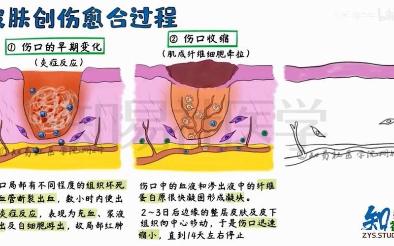 哪種補(bǔ)救方法副作用最小？ 行業(yè)新聞 第4張
